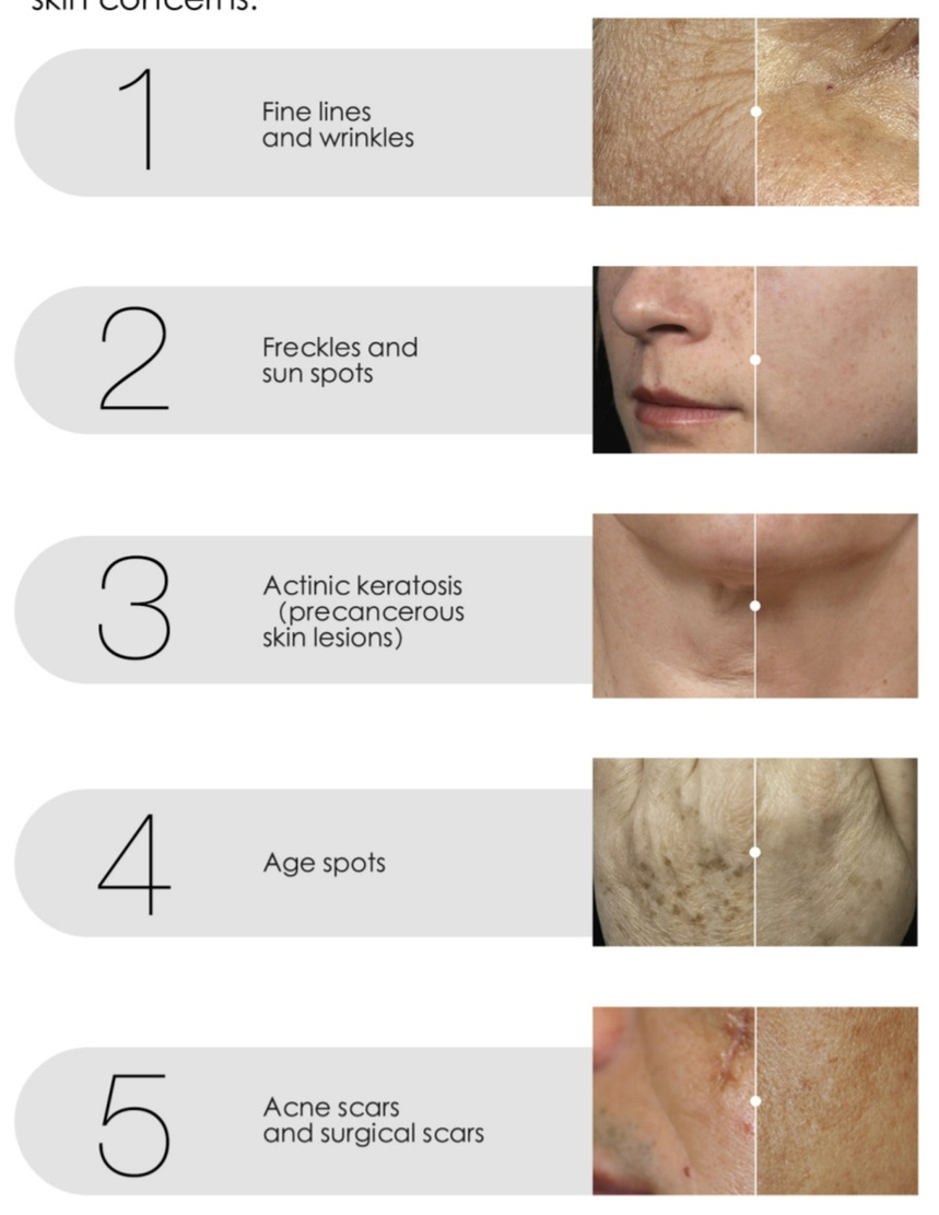 Zastosowania kliniczne Lumiàge